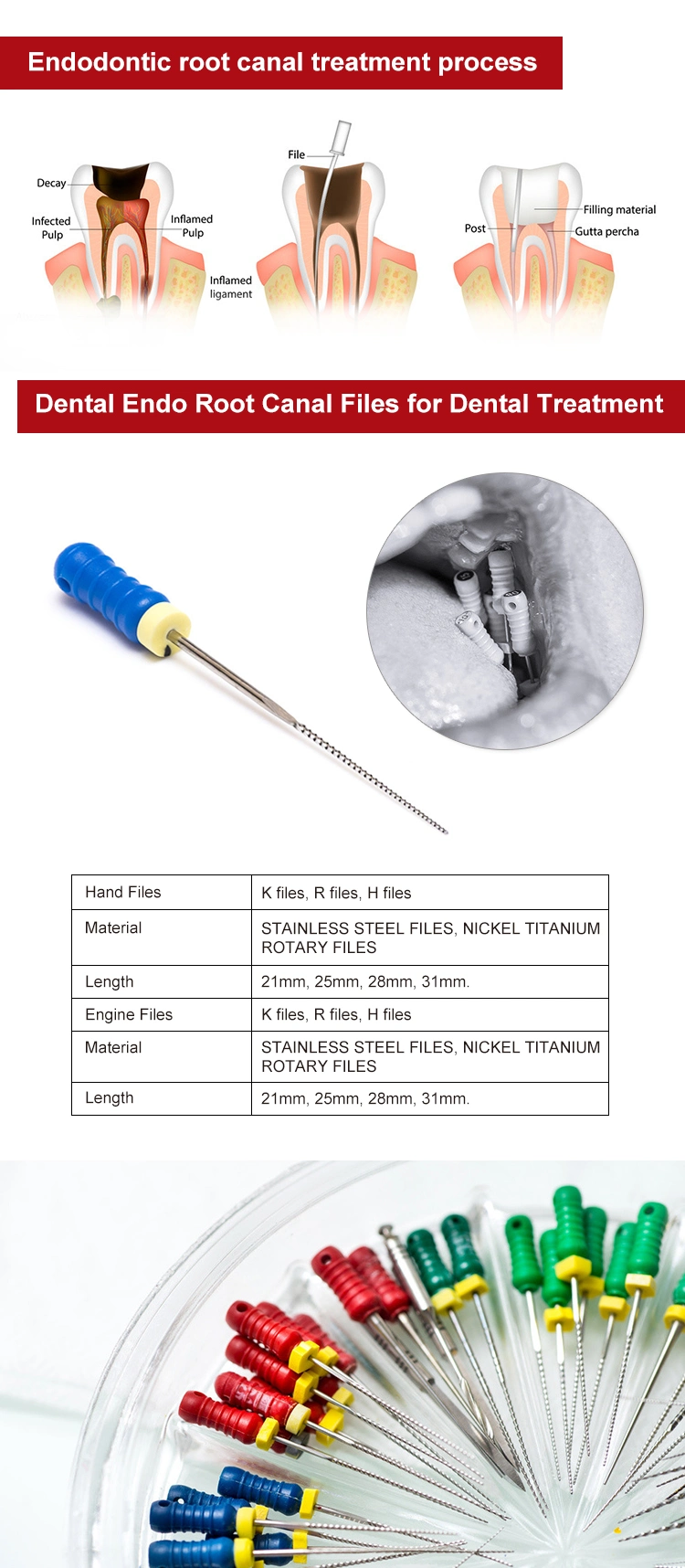 Niti Hand Dental Root Canal Files